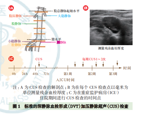 老年重癥患者靜脈血栓栓塞癥預(yù)防中國專家共識（2023）